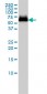 GBA Antibody (monoclonal) (M01)